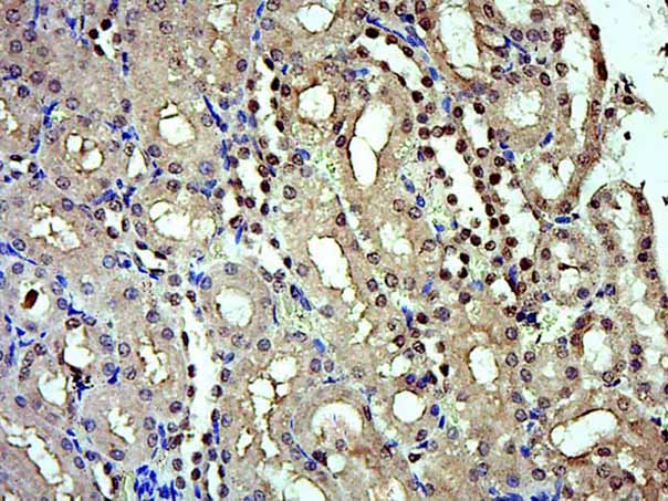 IRX5 Rabbit pAb(bs-9469R)-50ul