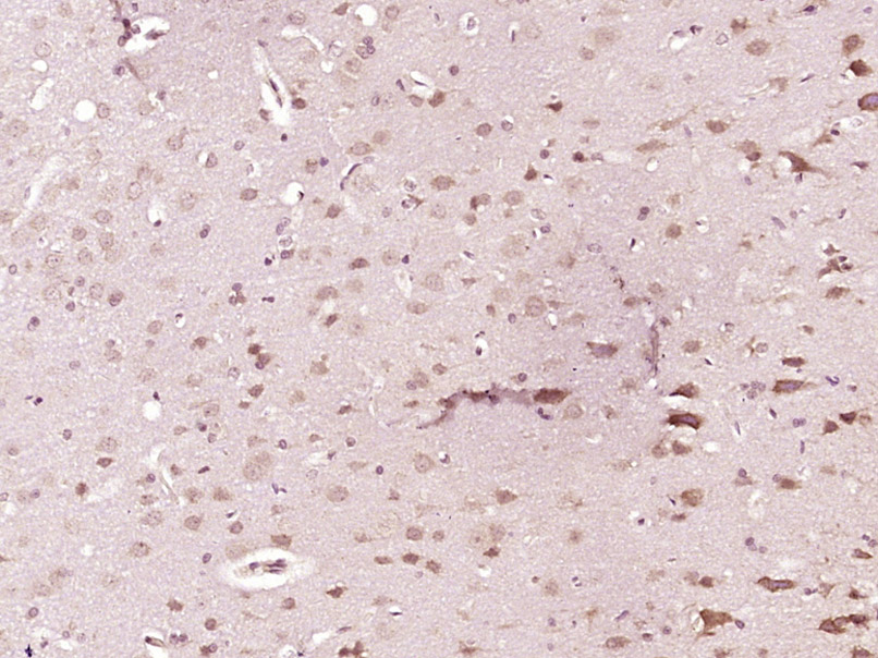 phospho-GluR1 (Ser849) Rabbit 