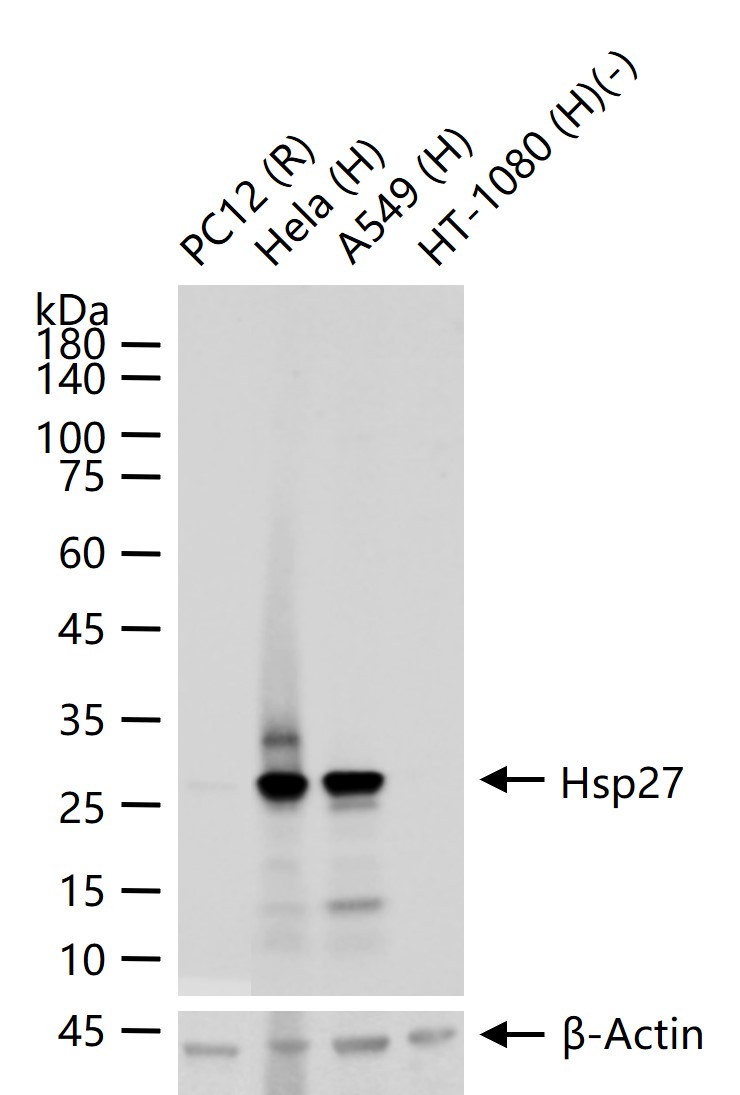 Hsp27 Recombinant Rabbit mAb(b