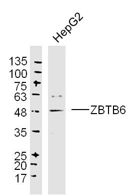 ZBTB6 Rabbit pAb(bs-13582R)-50
