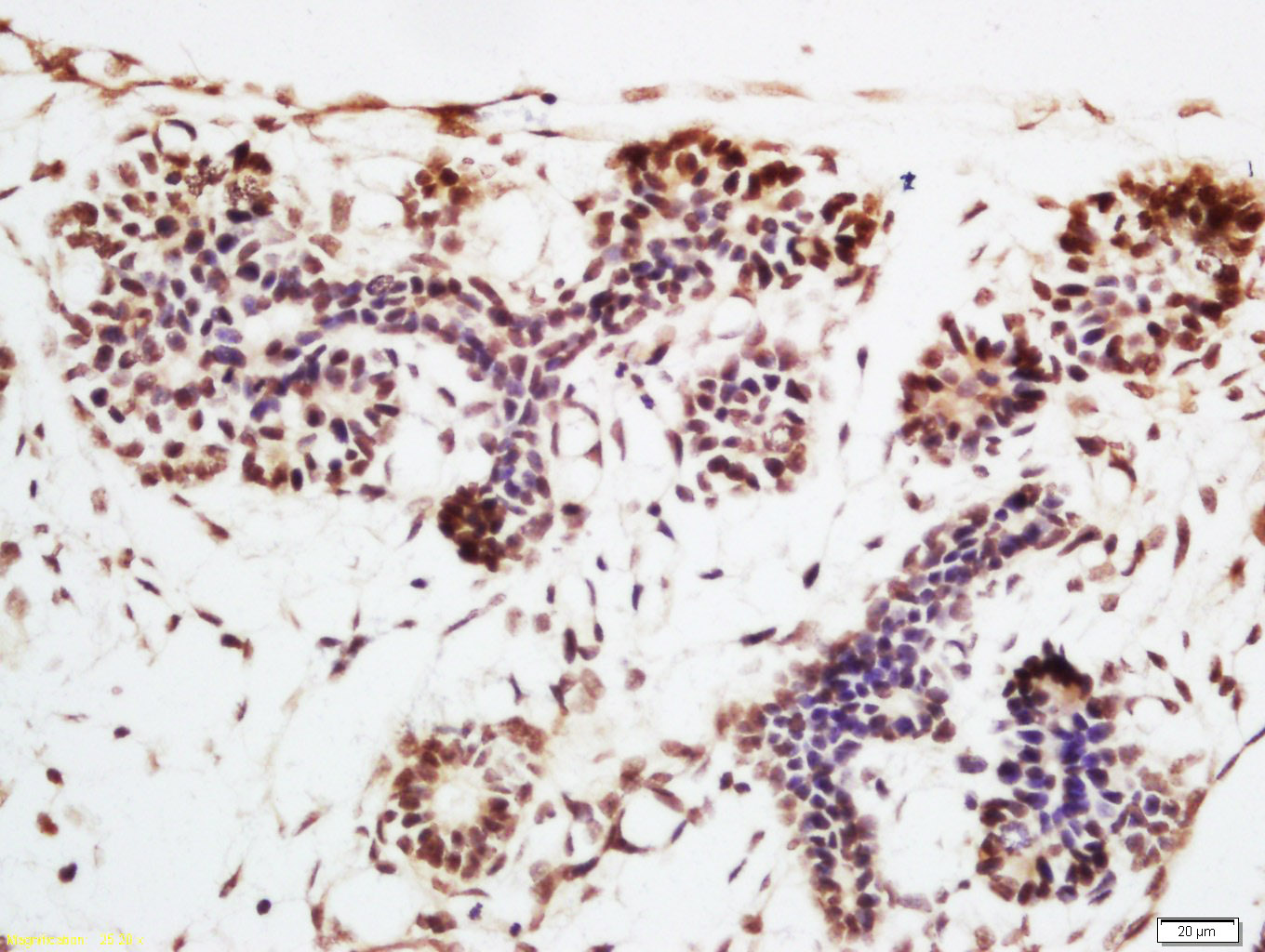 ENT2 Rabbit pAb(bs-10550R)-50u
