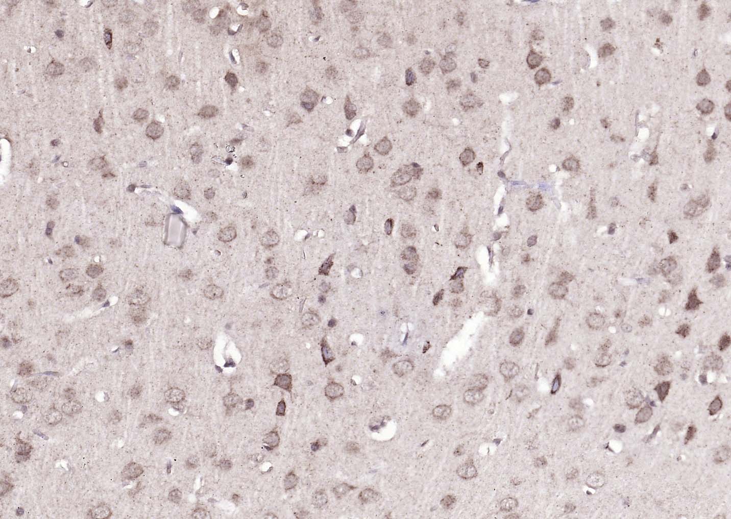 ATP7B Rabbit pAb(bs-1718R)-50u