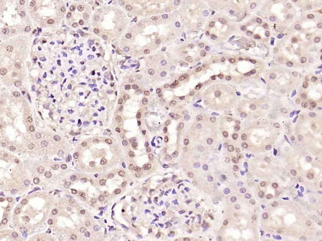 SMAD7 Rabbit pAb(bs-0566R)-50u