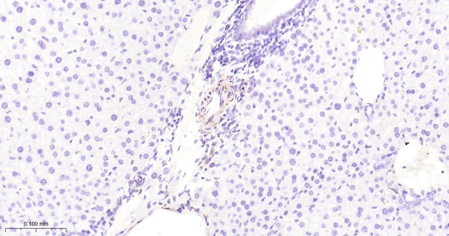 Hsp27 Recombinant Rabbit mAb(b