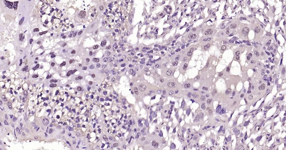 SNAI1 Rabbit pAb(bs-1371R)-50u