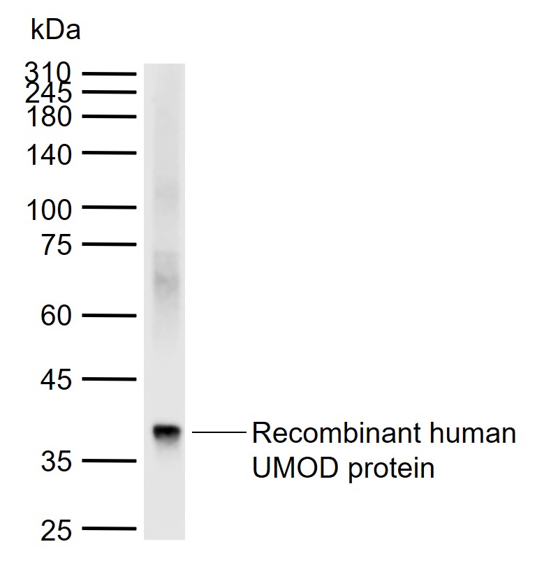 UMOD Rabbit pAb(bs-2189R)-50ul