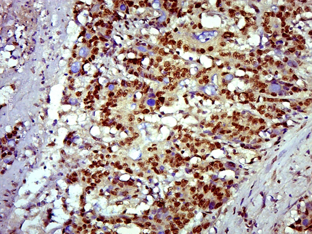 SOX9 Rabbit pAb(bs-4177R)-50ul