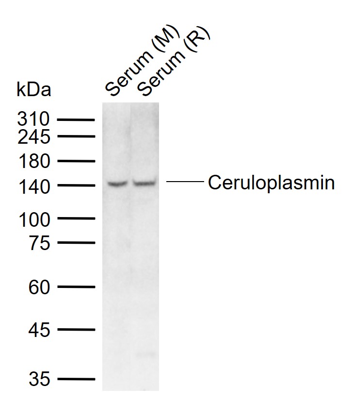Ceruloplasmin Rabbit pAb(bs-23