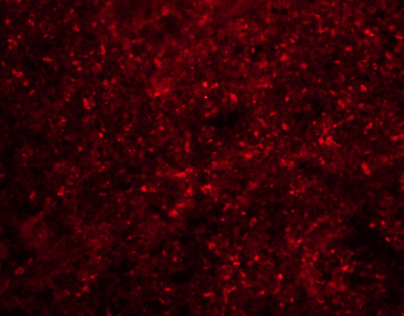 PLA2G7 Rabbit pAb(bs-1451R)-50