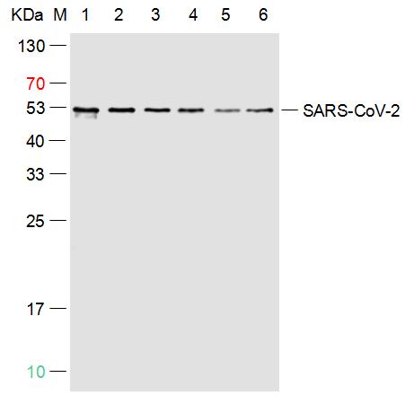 SARS-CoV-2 (2019-nCoV) Nucleoc