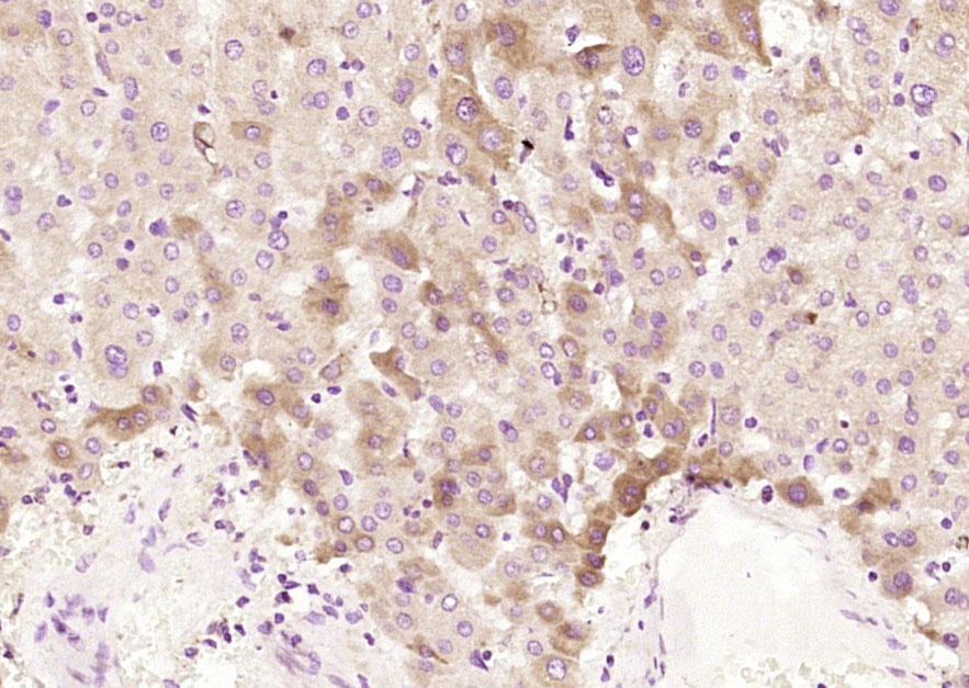 ACADM Rabbit pAb(bs-4047R)-50u