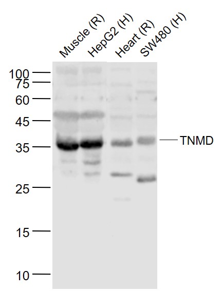 TNMD Rabbit pAb(bs-7525R)-50ul