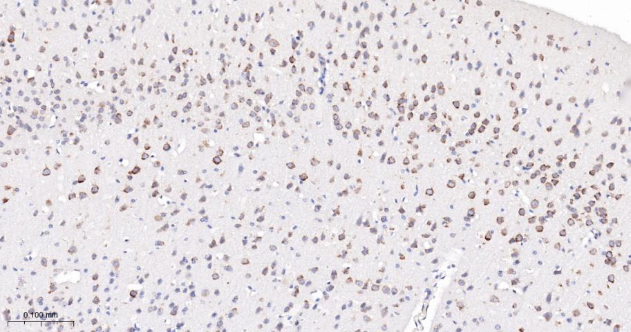 phospho-FoxO3a (Ser253) Recomb