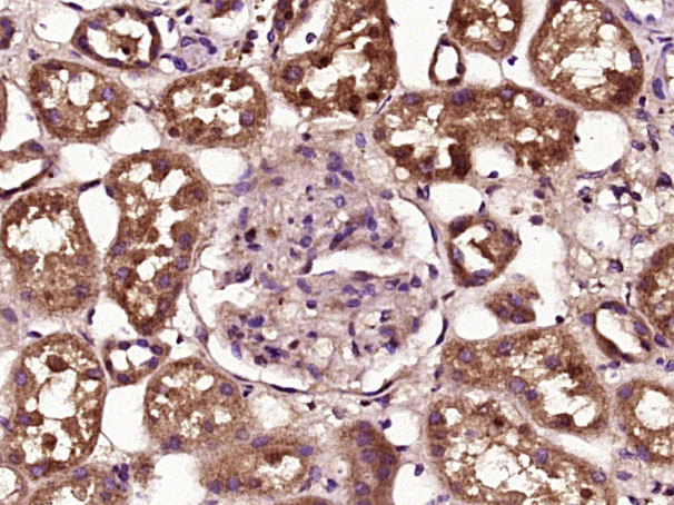 phospho-BAD (Ser99) Rabbit pAb