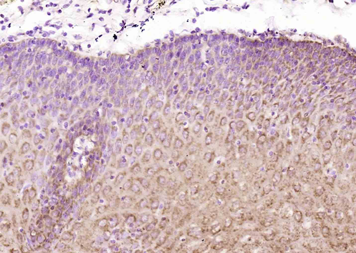 SPINK5/LEKTI Rabbit pAb(bs-176