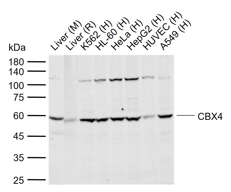 CBX4 Rabbit pAb(bs-17376R)-50u