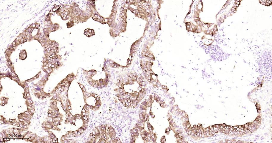 AGR2 Recombinant Rabbit mAb(bs