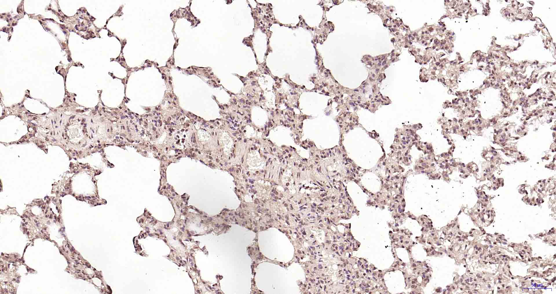 PSME3 Rabbit pAb(bs-4222R)-50u