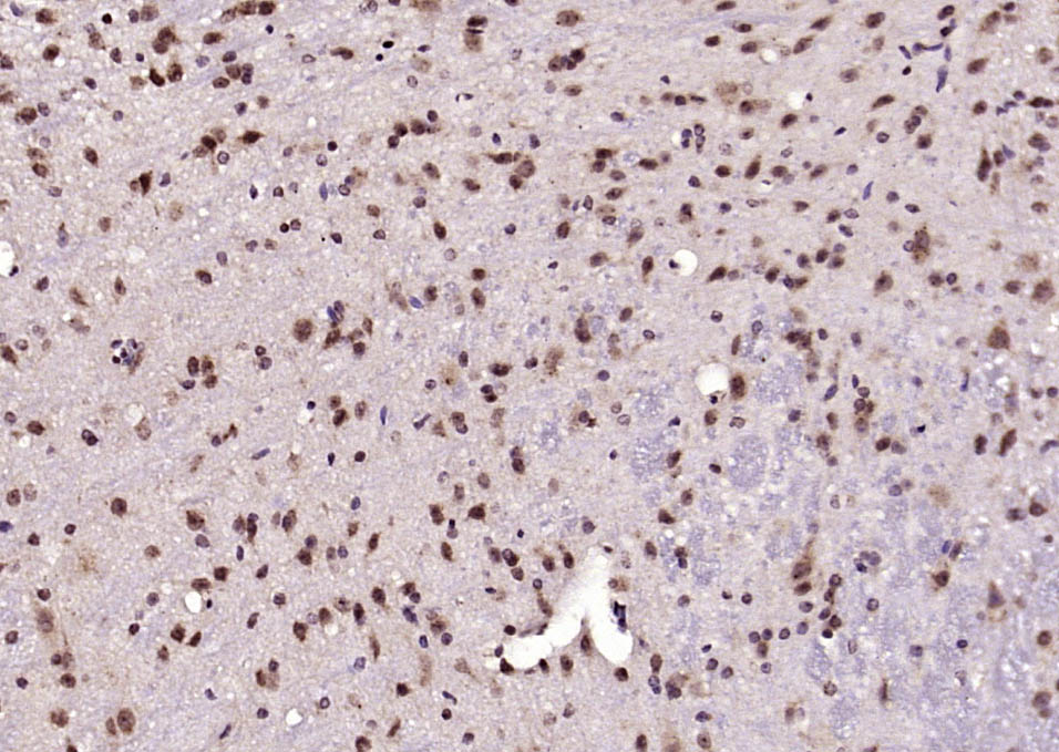 hnRNP Q Rabbit pAb(bs-17337R)-