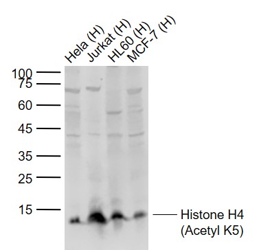Histone H4 (Acetyl K5) Rabbit 