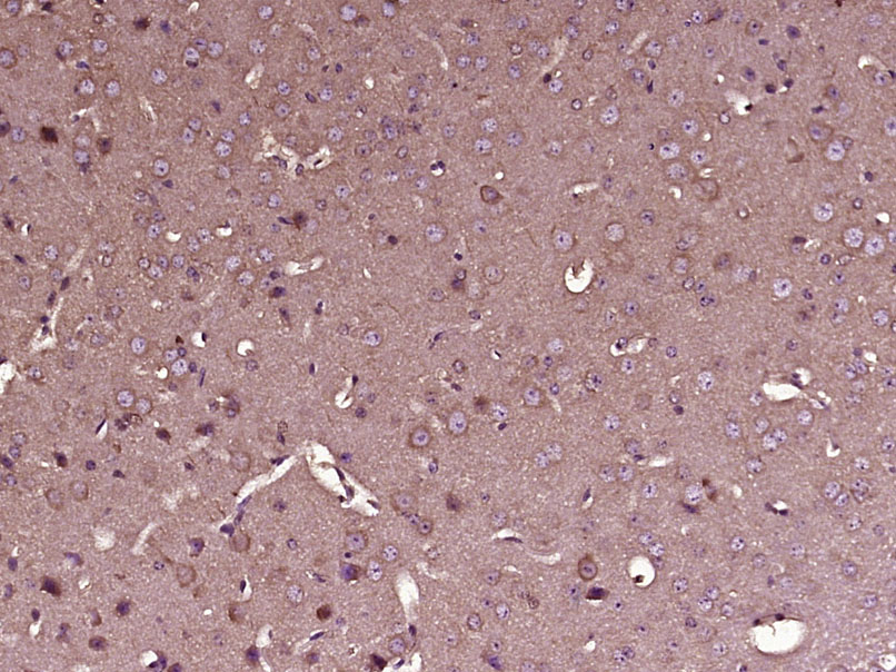 SIAH3 Rabbit pAb(bs-17481R)-50