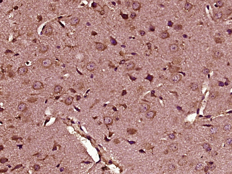 HOGA1 Rabbit pAb(bs-17348R)-50