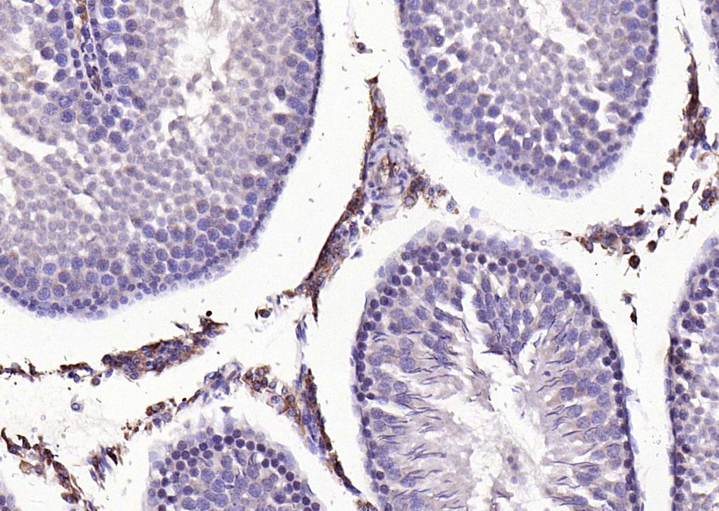 MMP-1 Rabbit pAb(bs-4597R)-50u