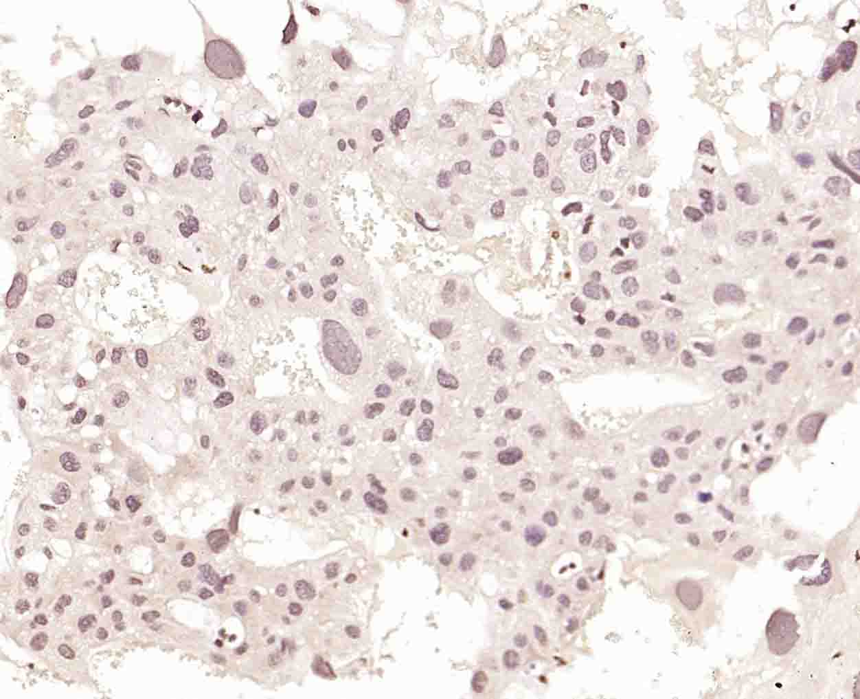 KLF6 Rabbit pAb(bs-1395R)-50ul