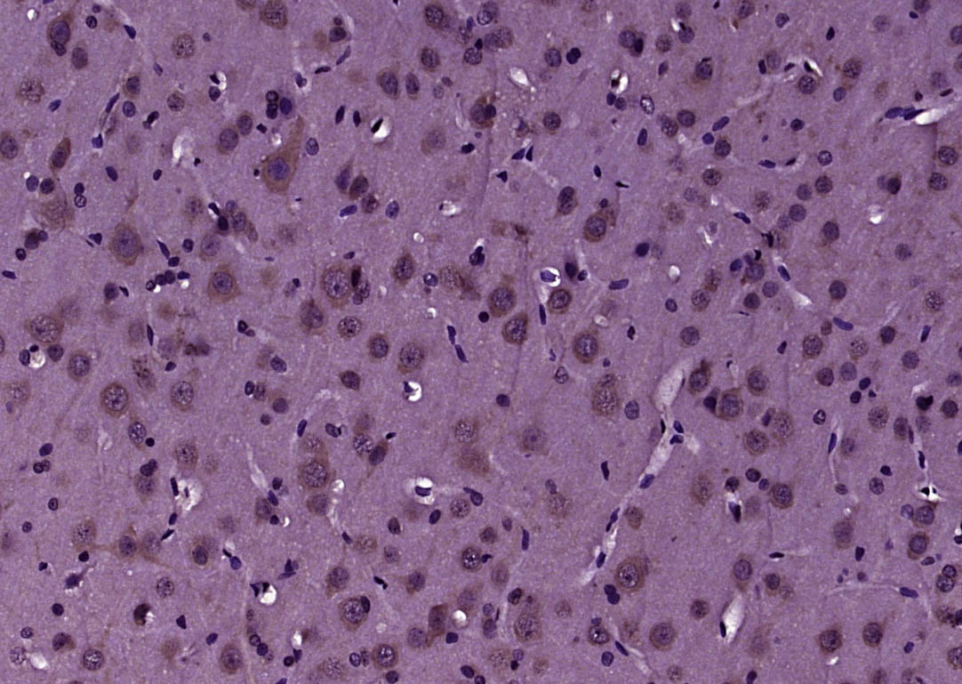 MLC1 Rabbit pAb(bs-7115R)-50ul