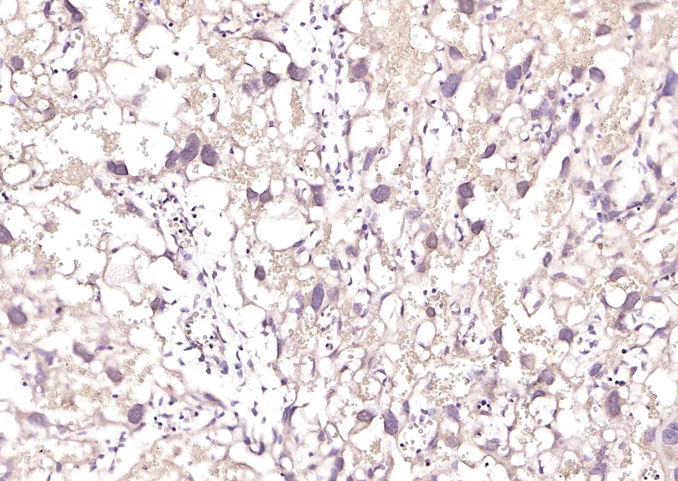 MLC1 Rabbit pAb(bs-7115R)-50ul