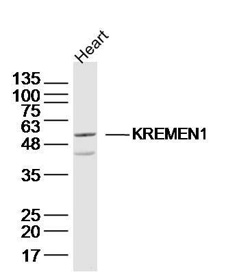 KREMEN1 Rabbit pAb(bs-16812R)-
