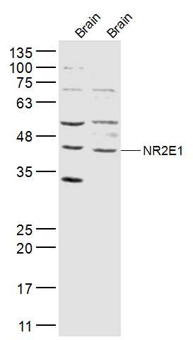 NR2E1 Rabbit pAb(bs-23116R)-50