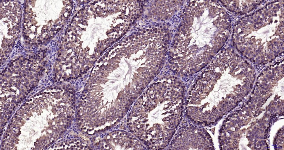 TBK1 Rabbit pAb(bs-7497R)-50ul