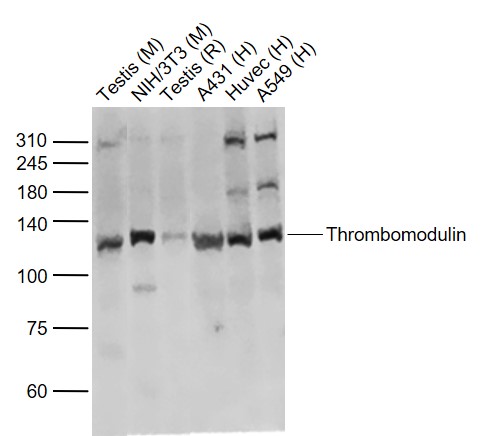 Thrombomodulin Rabbit pAb(bs-0