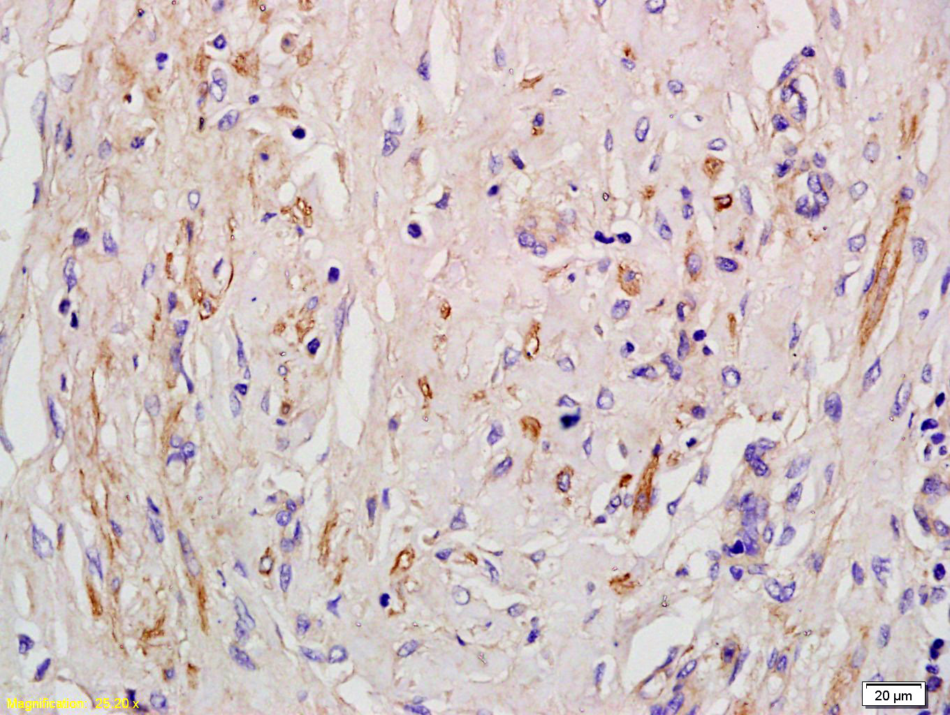 Angiotensin II Type 1 Receptor