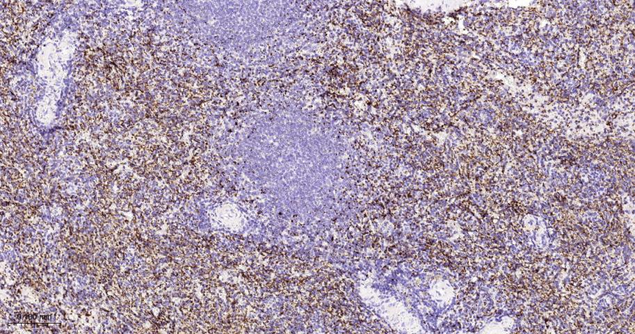 GP1BA Recombinant Rabbit mAb(b