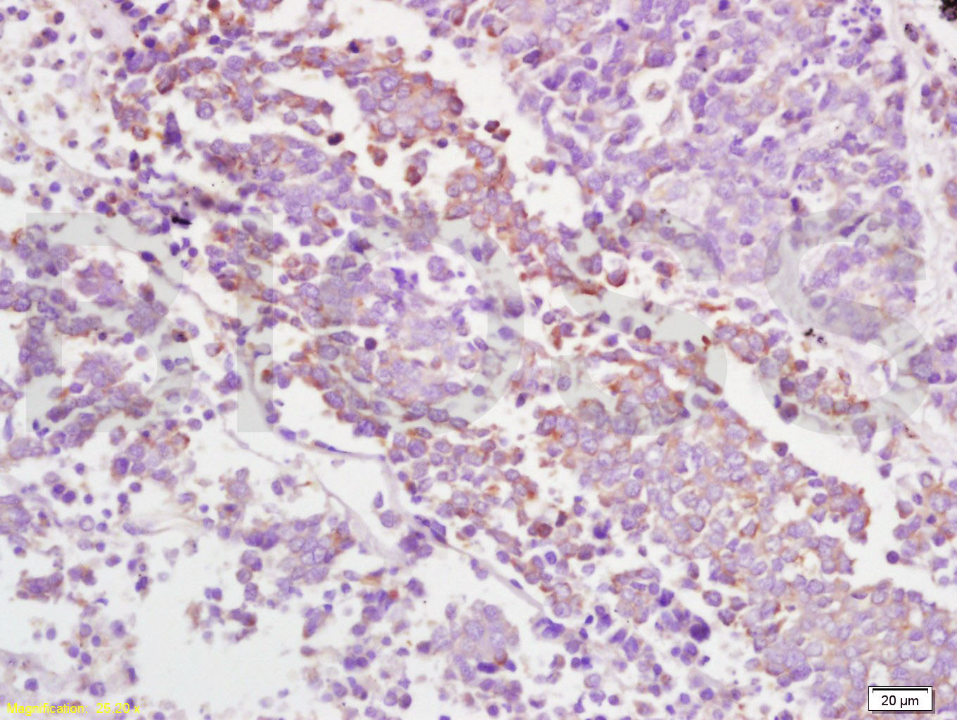 GRP94 Rabbit pAb(bs-0194R)-50u