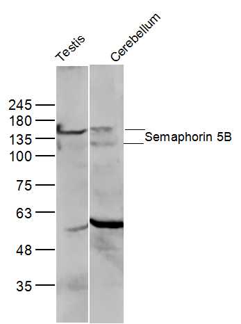 Semaphorin 5B Rabbit pAb(bs-11