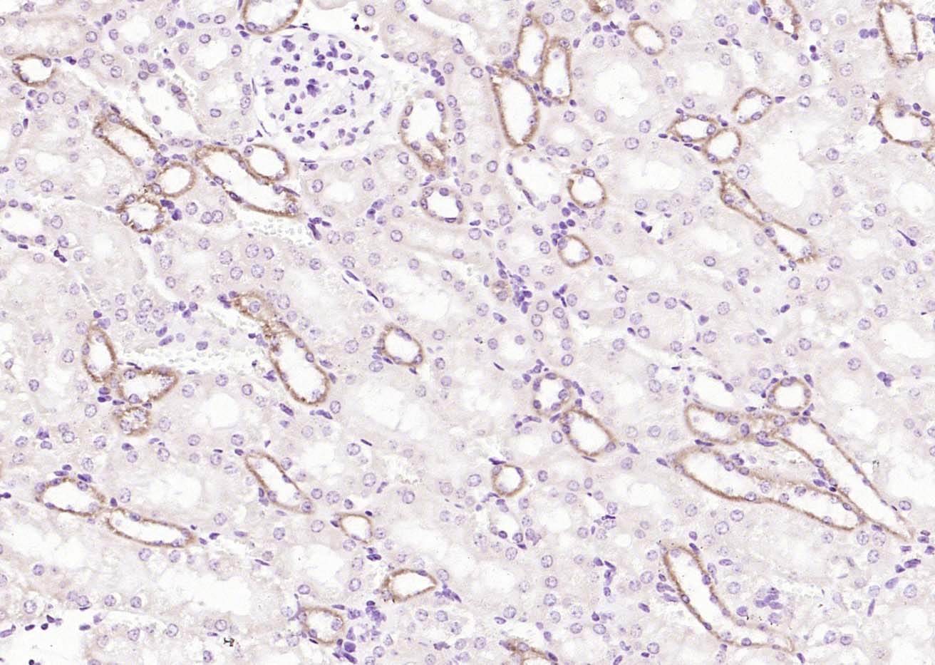 Angiotensin II Type 1 Receptor