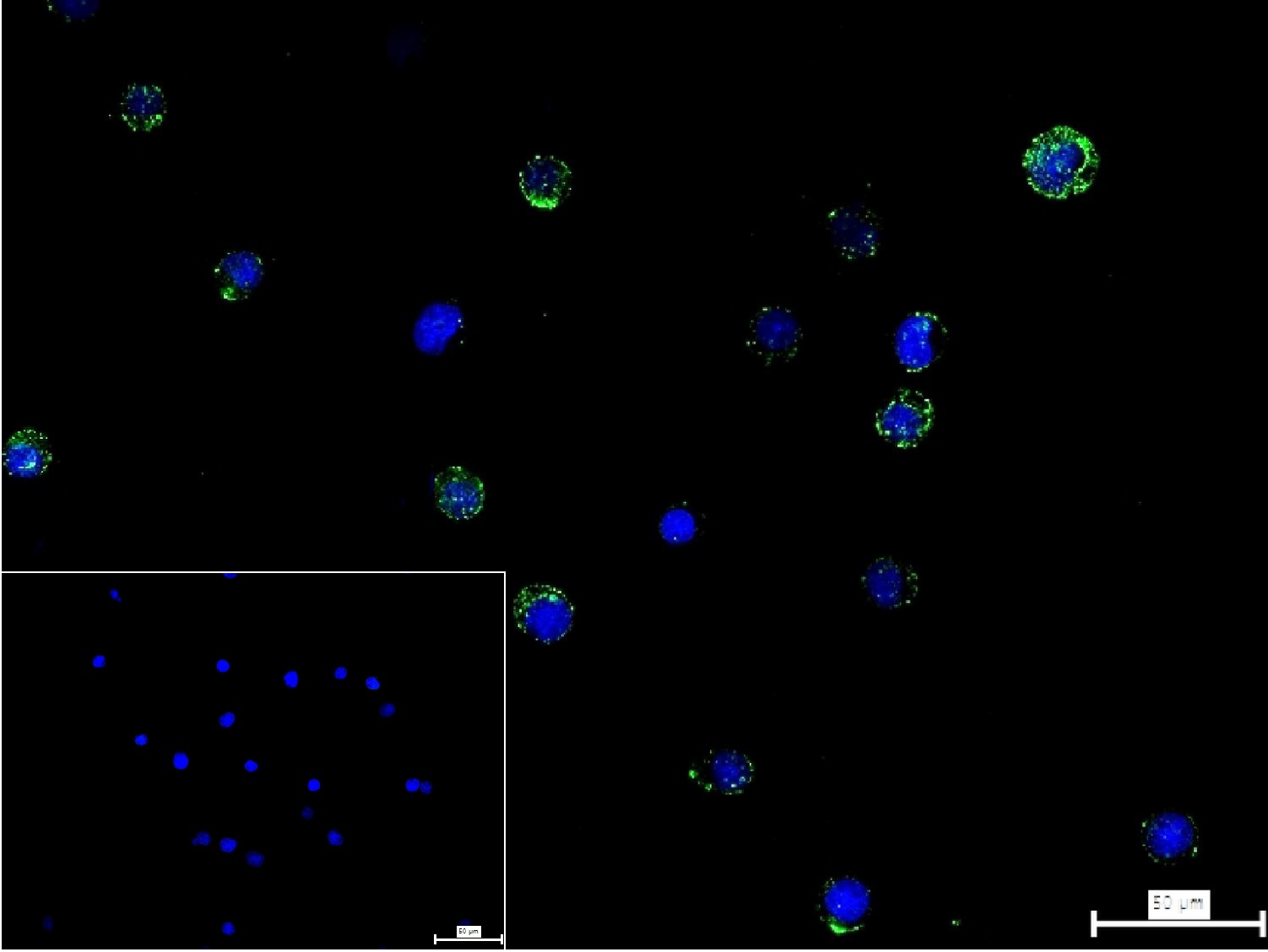 ADAM10 Recombinant Mouse mAb(b