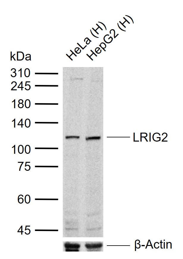 LRIG2 Rabbit pAb(bs-1845R)-50u