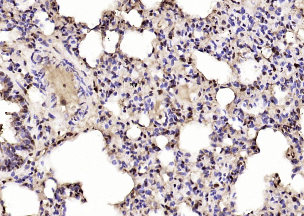 IGF2BP1 Rabbit pAb(bs-8683R)-5