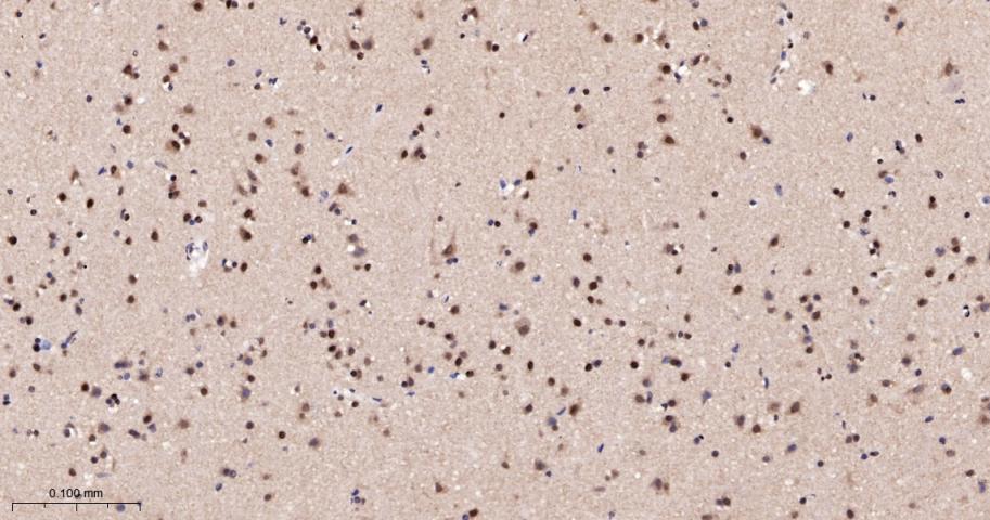 KDM4B Recombinant Rabbit mAb(b