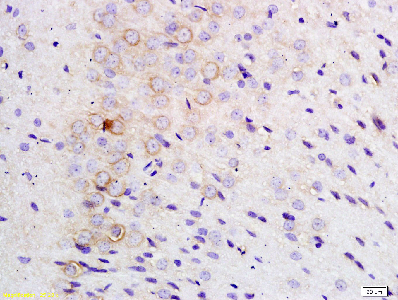 TLR1 Rabbit pAb(bs-1919R)-50ul