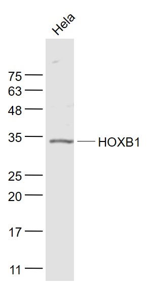 HOXB1 Rabbit pAb(bs-17363R)-50