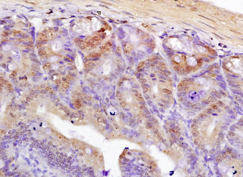 TCF7L2 Rabbit pAb(bs-1280R)-50