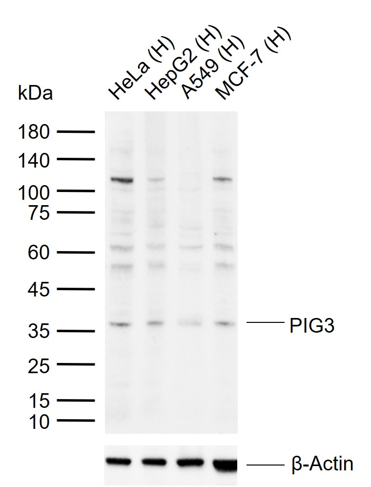 PIG3 Rabbit pAb(bs-6143R)-50ul