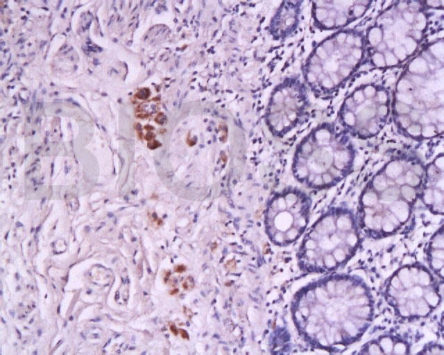 TFPI-2 Rabbit pAb(bs-1144R)-50