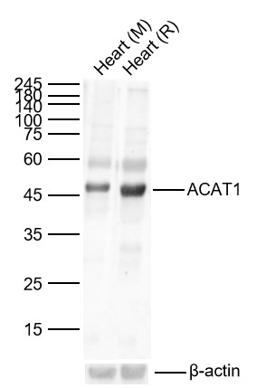 ACAT1 Rabbit pAb(bs-5019R)-50u