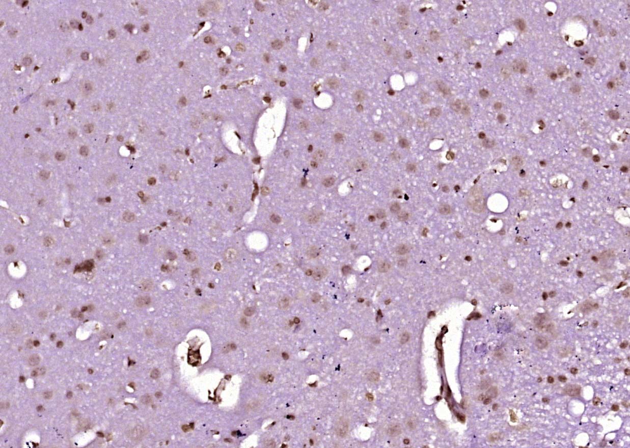 phospho-c-Abl (Tyr276) Rabbit 